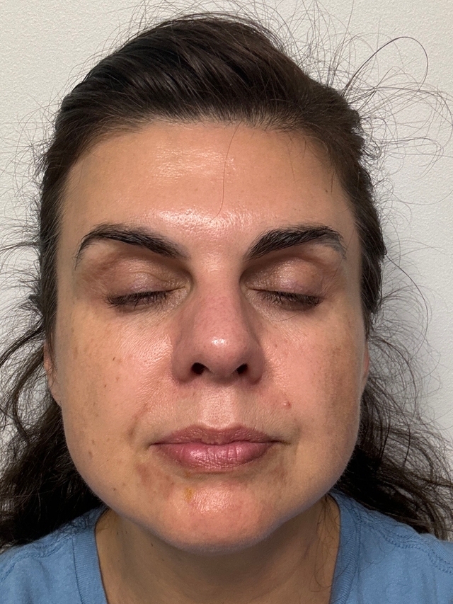 Halyna M., 46 Before