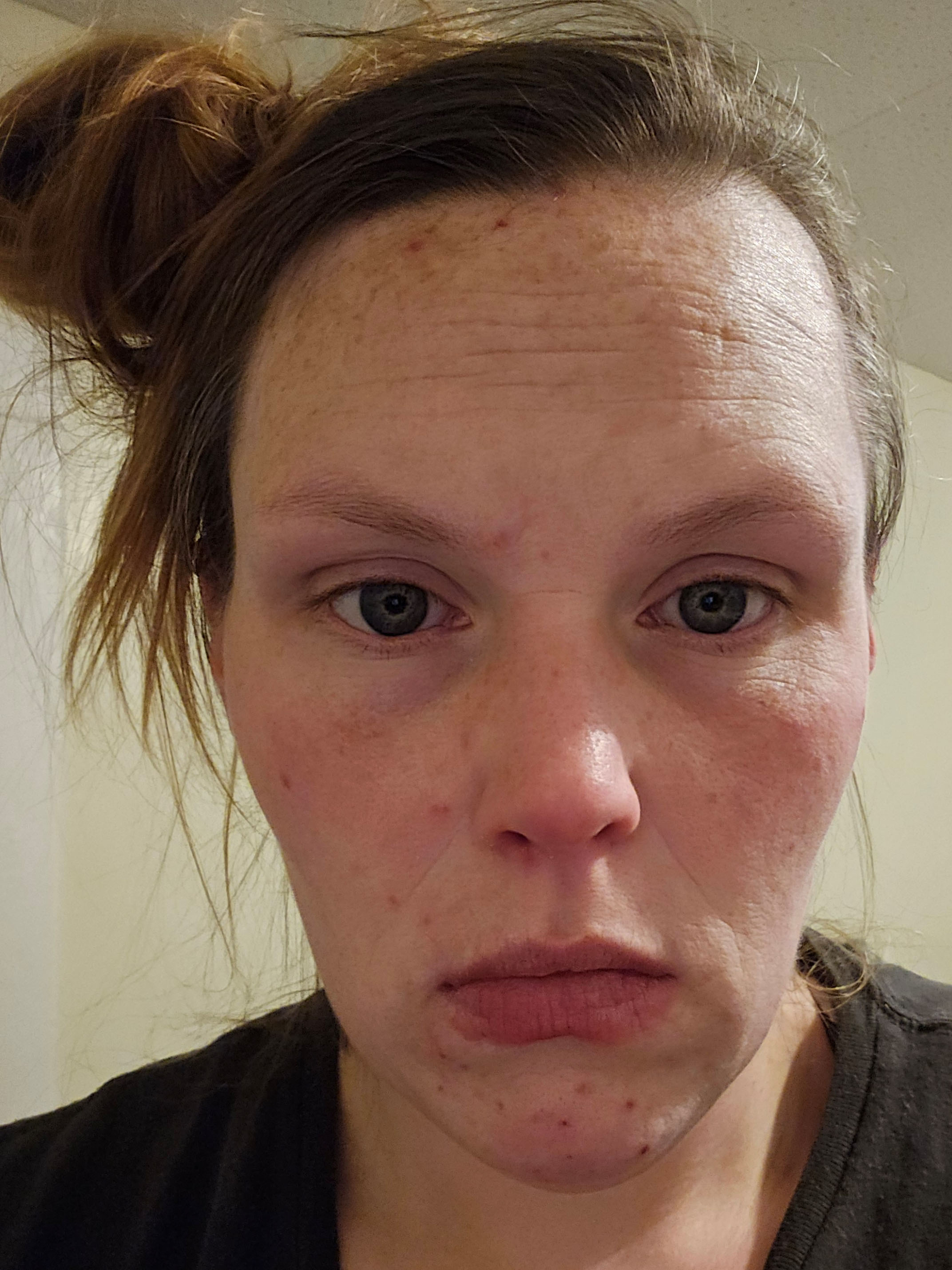 Alyssa C., 34 After