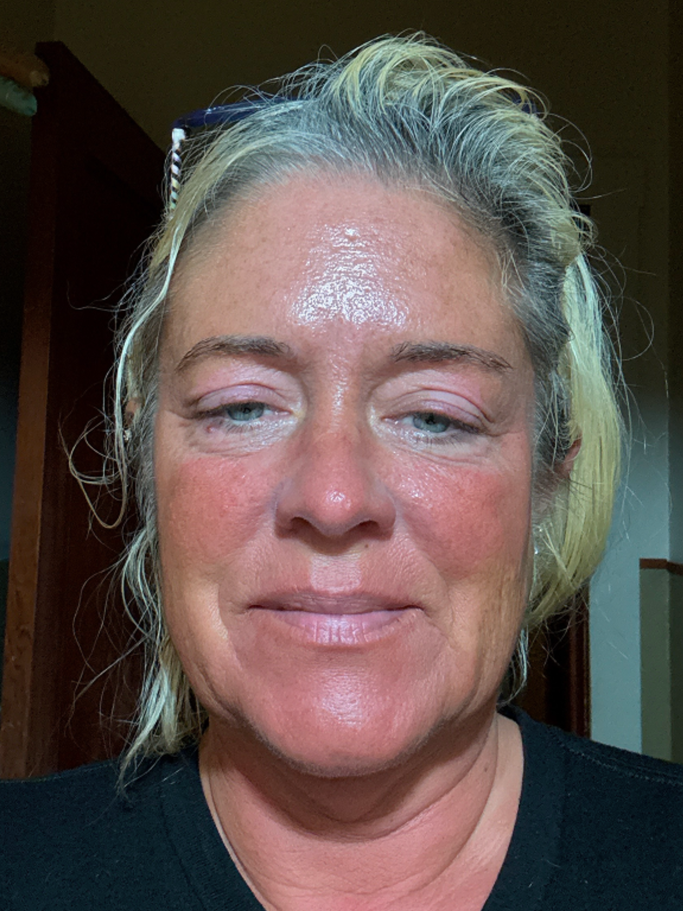 Christina C., 52 After